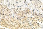 TSG101 Antibody in Immunohistochemistry (Paraffin) (IHC (P))