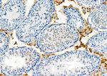 TSH Receptor Antibody in Immunohistochemistry (Paraffin) (IHC (P))