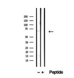 TSH Receptor Antibody in Western Blot (WB)