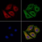 GCP5 Antibody in Immunocytochemistry (ICC/IF)