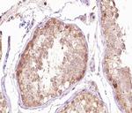 gamma Tubulin Antibody in Immunohistochemistry (Paraffin) (IHC (P))