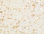 TUT1 Antibody in Immunohistochemistry (Paraffin) (IHC (P))