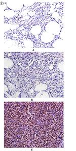 TWIST1 Antibody in Immunohistochemistry (Paraffin) (IHC (P))