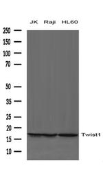 TWIST1 Antibody in Western Blot (WB)