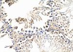 UBA3 Antibody in Immunohistochemistry (Paraffin) (IHC (P))