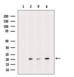 UBE2G1 Antibody in Western Blot (WB)