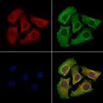 UNC5B Antibody in Immunocytochemistry (ICC/IF)