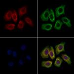 Kindlin 3 Antibody in Immunocytochemistry (ICC/IF)