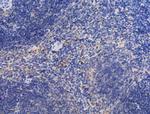 Kindlin 3 Antibody in Immunohistochemistry (Paraffin) (IHC (P))