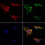 VDAC2 Antibody in Immunocytochemistry (ICC/IF)