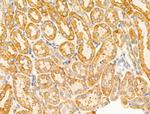 VDAC2 Antibody in Immunohistochemistry (Paraffin) (IHC (P))