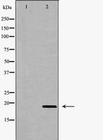 VEGFB Antibody in Western Blot (WB)