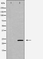 VHL Antibody in Western Blot (WB)