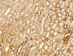 VLDLR Antibody in Immunohistochemistry (Paraffin) (IHC (P))