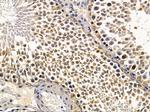 CHX10 Antibody in Immunohistochemistry (Paraffin) (IHC (P))