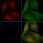 WARS Antibody in Immunocytochemistry (ICC/IF)