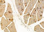 WARS Antibody in Immunohistochemistry (Paraffin) (IHC (P))