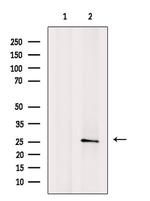 WARS Antibody in Western Blot (WB)