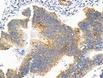 WIPI1 Antibody in Immunohistochemistry (Paraffin) (IHC (P))