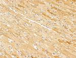 WIPI1 Antibody in Immunohistochemistry (Paraffin) (IHC (P))