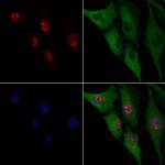 WT1 Antibody in Immunocytochemistry (ICC/IF)