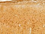 XAF1 Antibody in Immunohistochemistry (Paraffin) (IHC (P))