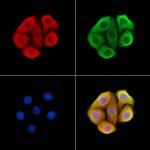 XCR1 Antibody in Immunocytochemistry (ICC/IF)