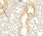 SLC7A11 Antibody in Immunohistochemistry (Paraffin) (IHC (P))