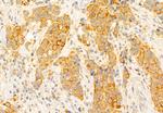 SLC7A11 Antibody in Immunohistochemistry (Paraffin) (IHC (P))