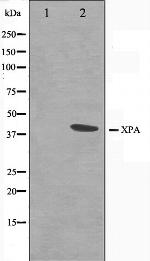 XPA Antibody in Western Blot (WB)