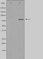 ZC3H11A Antibody in Western Blot (WB)