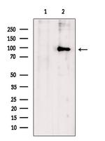 ZNF281 Antibody in Western Blot (WB)