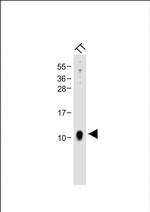 CGRP Antibody in Western Blot (WB)