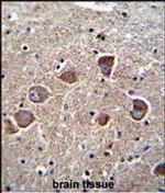 PPAPDC1A Antibody in Immunohistochemistry (Paraffin) (IHC (P))