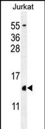 Histone H2A.Z Antibody in Western Blot (WB)