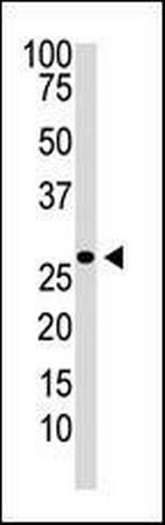 DKK2 Antibody in Western Blot (WB)