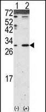 DKK2 Antibody in Western Blot (WB)