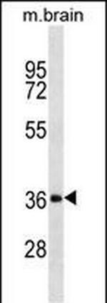 DKK2 Antibody in Western Blot (WB)