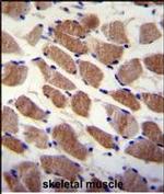 SAMD7 Antibody in Immunohistochemistry (Paraffin) (IHC (P))