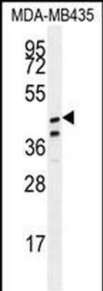 SAMD7 Antibody in Western Blot (WB)