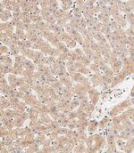 LC3B Antibody in Immunohistochemistry (Paraffin) (IHC (P))