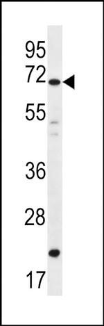 DAZ4 Antibody in Western Blot (WB)