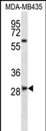 SLAMF8 Antibody in Western Blot (WB)