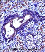 ACTG2 Antibody in Immunohistochemistry (Paraffin) (IHC (P))