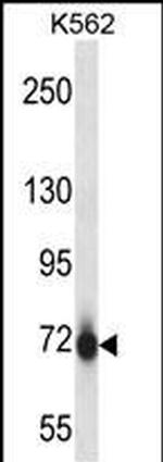 PAK7 Antibody in Western Blot (WB)