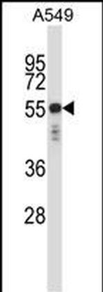 Cytokeratin 6 Antibody in Western Blot (WB)