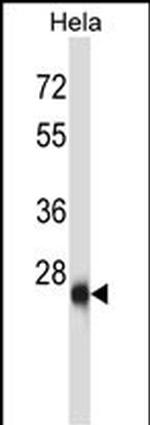 ZIC4 Antibody in Western Blot (WB)