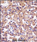 SULT1A3 Antibody in Immunohistochemistry (Paraffin) (IHC (P))