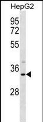 SULT1A3 Antibody in Western Blot (WB)