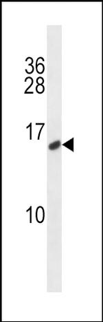 Calcitonin Antibody in Western Blot (WB)